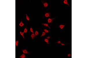 ABIN6266820 staining Hela by IF/ICC. (MAST3 antibody  (Internal Region))