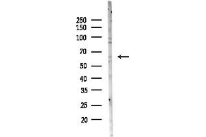anti-Zinc Finger Protein 682 (ZNF682) (N-Term) antibody
