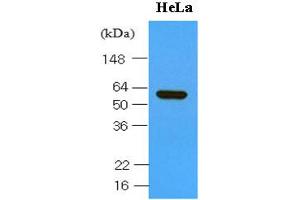 Western blot analysis: Cell lysates of Hela (30ug) were resolved by SDS-PAGE, transferred to NC membrane and probed with anti-human HSP60 (1:1000). (HSPD1 antibody  (AA 1-573))