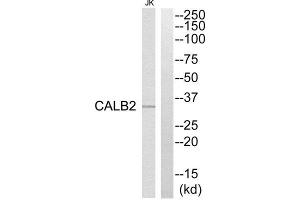 Western Blotting (WB) image for anti-Calbindin 2 (CALB2) (Internal Region) antibody (ABIN1850973) (Calretinin antibody  (Internal Region))