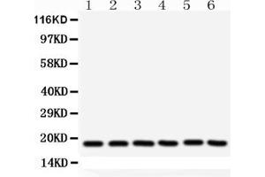 Western blot analysis of SOD1 using anti- SOD1 antibody . (SOD1 antibody  (C-Term))