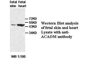 Image no. 2 for anti-Medium-Chain Specific Acyl-CoA Dehydrogenase, Mitochondrial antibody (ABIN791208) (Medium-Chain Specific Acyl-CoA Dehydrogenase, Mitochondrial antibody)