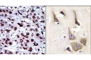 Image no. 2 for anti-Adenylate Kinase 5 (AK5) (N-Term) antibody (ABIN360616) (Adenylate Kinase 5 antibody  (N-Term))