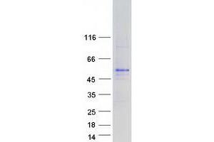 Validation with Western Blot