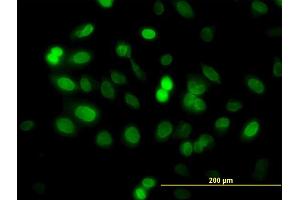 Immunofluorescence of monoclonal antibody to ZNF21 on HeLa cell. (ZNF182 antibody  (AA 81-190))