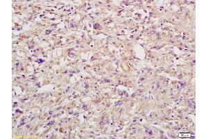 Immunohistochemistry (IHC) image for anti-Interleukin 6 Signal Transducer (Gp130, Oncostatin M Receptor) (IL6ST) (AA 651-750) antibody (ABIN686842)