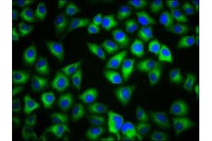 Immunofluorescence staining of Hela cells with ABIN7159233 at 1:133, counter-stained with DAPI. (MC1 Receptor antibody  (AA 1-37))
