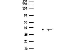 anti-Poly(rC) Binding Protein 2 (PCBP2) (Internal Region) antibody