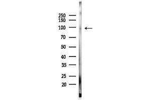 Western blot analysis of lysates from Rat testis, using Phospho-EPS15 (Tyr849) Antibody at 1/1000 dilution.