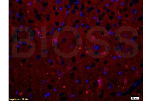 Immunofluorescence (IF) image for anti-Tumor Necrosis Factor Receptor Superfamily, Member 11a, NFKB Activator (TNFRSF11A) (AA 51-150) antibody (ABIN749258)
