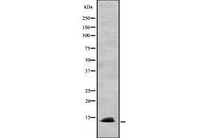 Western blot analysis of CCL24 expression in HEK293 cells ,The lane on the left is treated with the antigen-specific peptide. (CCL24 antibody  (C-Term))