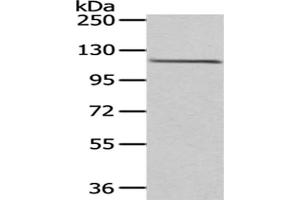 Gel: 6 % SDS-PAGE,Lysate: 40 μg,Primary antibody: ABIN7193040(WDR36 Antibody) at dilution 1/200 dilution,Secondary antibody: Goat anti rabbit IgG at 1/8000 dilution,Exposure time: 1 minute (WDR36 antibody)