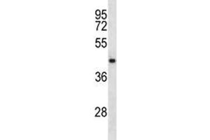 NDRG2 antibody western blot analysis in CEM lysate. (NDRG2 antibody  (AA 42-70))