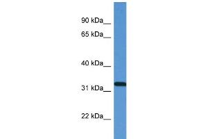 WB Suggested Anti-ZAP70 Antibody Titration: 1. (ZAP70 antibody  (N-Term))