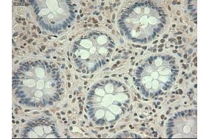 Image no. 17 for anti-Myc Proto-Oncogene protein (MYC) antibody (ABIN1497011) (c-MYC antibody)