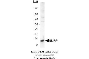 Image no. 1 for anti-SRA Stem-Loop Interacting RNA Binding Protein (SLIRP) (C-Term) antibody (ABIN363541) (SLIRP antibody  (C-Term))