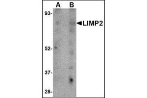 Western blot analysis of LIMP2 in human skeletal muscle tissue lysate with this product at (A) 1 and (B) 2 μg/ml.
