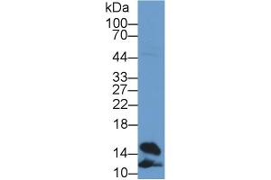 Detection of FABP4 in Rat Heart lysate using Polyclonal Antibody to Fatty Acid Binding Protein 4 (FABP4) (FABP4 antibody  (AA 2-132))