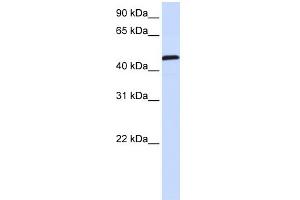 WB Suggested Anti-UMPS Antibody Titration:  0. (UMPS antibody  (C-Term))