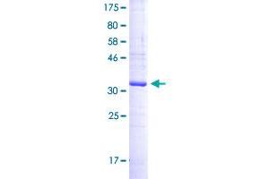 Image no. 1 for Tetraspanin 26 (TSPAN26) (AA 112-211) protein (GST tag) (ABIN2565252)