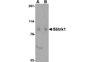 Western Blotting (WB) image for anti-SLIT and NTRK-Like Family, Member 1 (SLITRK1) (C-Term) antibody (ABIN1030680) (SLITRK1 antibody  (C-Term))