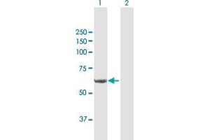 Western Blot analysis of P4HA1 expression in transfected 293T cell line by P4HA1 MaxPab polyclonal antibody. (P4HA1 antibody  (AA 1-534))