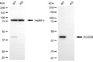 Western blotting analysis using ACADM antibody (ABIN7799352). (Recombinant Medium-Chain Specific Acyl-CoA Dehydrogenase, Mitochondrial (MCAD) antibody)