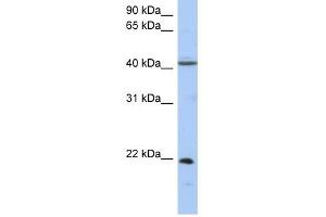 GUK1 antibody used at 1 ug/ml to detect target protein. (GUK1 antibody  (Middle Region))