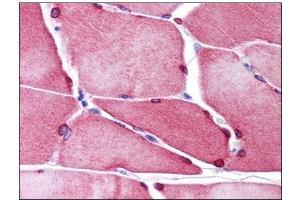 Human Skeletal Muscle: Formalin-Fixed, Paraffin-Embedded (FFPE) (TMEM38A antibody  (C-Term))