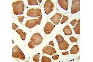 IHC analysis of FFPE human skeletal muscle stained with ANGPTL4 antibody (ANGPTL4 antibody  (AA 138-167))