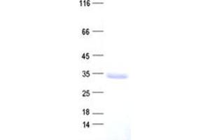 Validation with Western Blot (FBXO25 Protein (His tag))