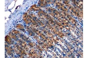 Detection of C5a in Rat Stomach Tissue using Monoclonal Antibody to Complement Component 5a (C5a) (C5A antibody  (AA 1-77))