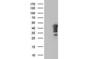 Western Blotting (WB) image for anti-Homeobox C11 (HOXC11) (AA 1-304) antibody (ABIN1490736) (HOXC11 antibody  (AA 1-304))