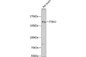 Western blot analysis of extracts of rat brain, using TTBK2 antibody (ABIN6131392, ABIN6149666, ABIN6149669 and ABIN6223523) at 1:1000 dilution. (TTBK2 antibody  (AA 1185-1244))