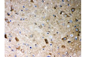 Immunohistochemistry (IHC) image for anti-Protein Phosphatase 2, Catalytic Subunit, alpha Isozyme (PPP2CA) (AA 1-309) antibody (ABIN3043356)