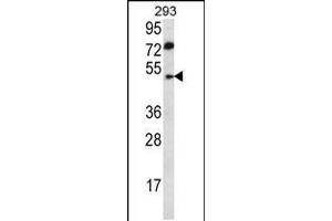 Western blot analysis in 293 cell line lysates (35ug/lane). (ABHD2 antibody  (AA 263-292))