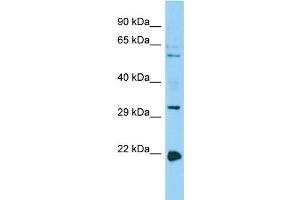 Host: Rabbit Target Name: CORO1B Sample Type: HepG2 Whole Cell lysates Antibody Dilution: 1. (CORO1B antibody  (C-Term))