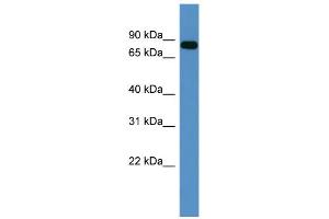 WB Suggested Anti-COL9A3 Antibody Titration: 0.