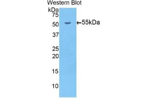 Detection of Recombinant bACE1, Mouse using Polyclonal Antibody to Beta-Site APP Cleaving Enzyme 1 (bACE1) (BACE1 antibody  (AA 190-430))