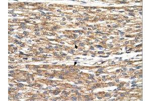 Image no. 1 for anti-Patatin-Like phospholipase Domain Containing 3 (PNPLA3) (C-Term) antibody (ABIN6738525) (PNPLA3 antibody  (C-Term))