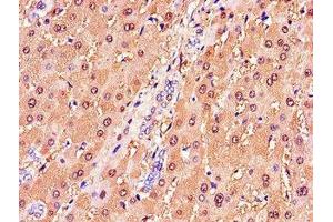 Immunohistochemistry of paraffin-embedded human liver tissue using ABIN7154085 at dilution of 1:100 (GSTA1 antibody  (AA 2-222))