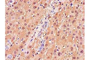 Immunohistochemistry of paraffin-embedded human liver tissue using ABIN7154085 at dilution of 1:100