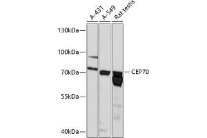 Western blot analysis of extracts of various cell lines, using CEP70 antibody (ABIN6129670, ABIN6138429, ABIN6138430 and ABIN6218042) at 1:3000 dilution. (CEP70 antibody  (AA 1-280))