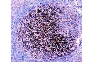 IHC-P: CD82 antibody testing of human tonsil tissue (CD82 antibody  (AA 98-267))