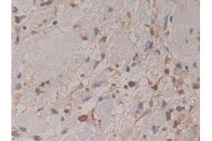 Immunohistochemistry (IHC) image for anti-Cytohesin 1 (CYTH1) (AA 1-398) antibody (ABIN7443203)