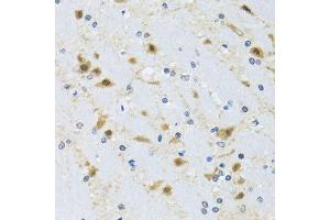 Immunohistochemistry of paraffin-embedded mouse brain using CCT4 antibody. (CCT4 antibody  (AA 130-390))