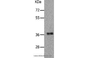Western blot analysis of Human fetal muscle tissue, using PARD6A Polyclonal Antibody at dilution of 1:650 (PARD6A antibody)