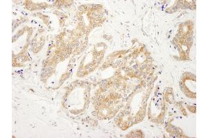 Immunohistochemistry (IHC) image for anti-DEAD (Asp-Glu-Ala-Asp) Box Polypeptide 6 (DDX6) (AA 1-50) antibody (ABIN7448524) (DDX6 antibody  (AA 1-50))