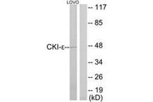 Western blot analysis of extracts from LOVO cells, using CKI-epsilon Antibody. (CK1 epsilon antibody  (AA 276-325))
