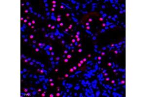 Immunofluorescence of paraffin embedded rat kidney using PRPF3 (ABIN7075311) at dilution of 1: 2200 (400x lens) (PRPF3 antibody)